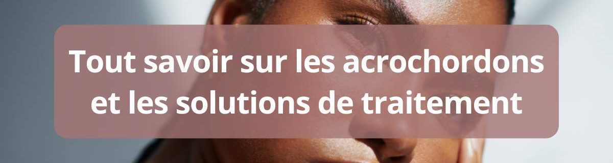 Tout savoir sur les acrochordons et les solutions de traitement-complet